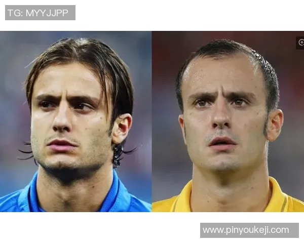 足球明星们的植发故事揭秘你不知道的那些球员经历 足球明星们的植发故事揭秘你不知道的那些球员经历